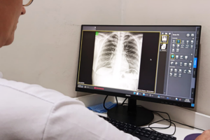 Prefeitura viabiliza serviço de Raio-X 24h na UPA de Castro
